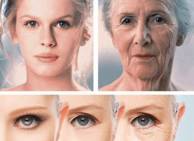 Типы старения кожи